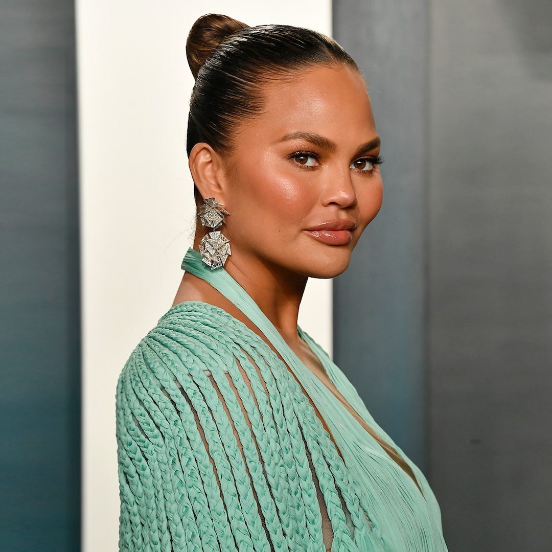 Pregnant Chrissy Teigen Hospitalized For Excessive Bleeding E Online
